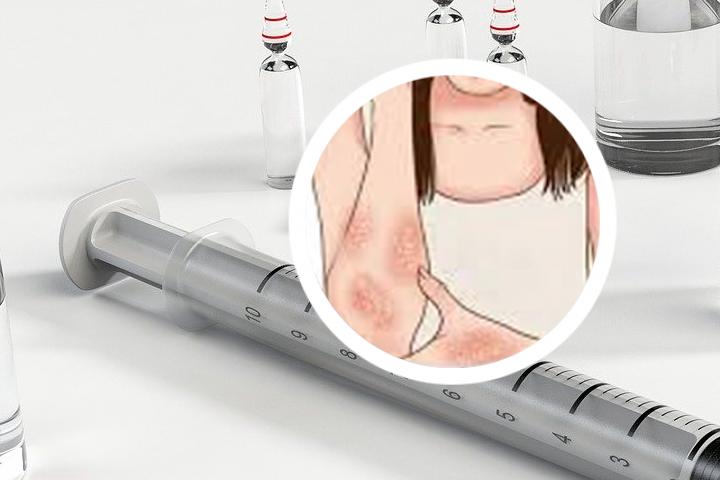 郑州治牛皮癣比较好的地方