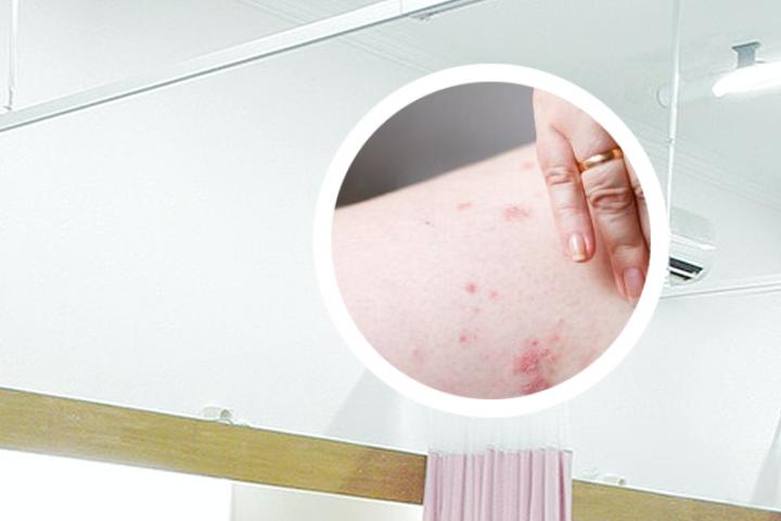 牛皮癣患者用什么身体乳好