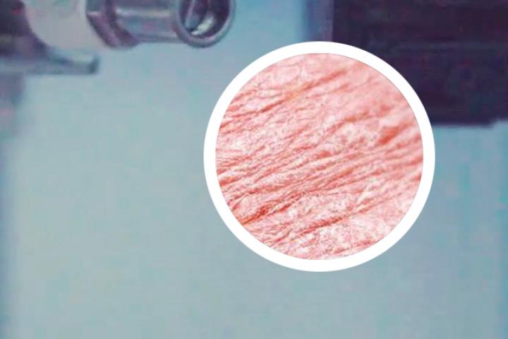专治牛皮癣的喷雾