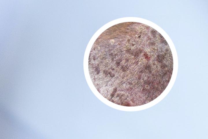 患牛皮癣能打流感疫苗吗