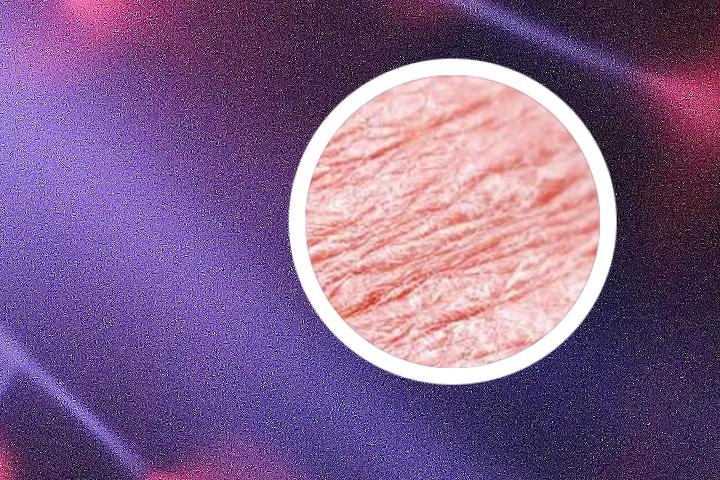甘松煮水洗对牛皮癣有用吗