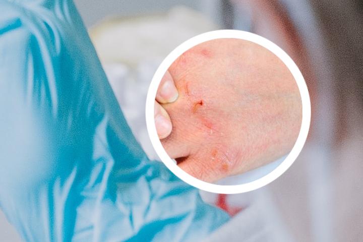 潍坊银屑病医院医生介绍