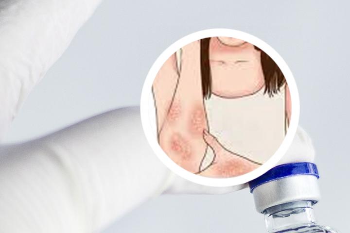 宝宝头上像牛皮癣