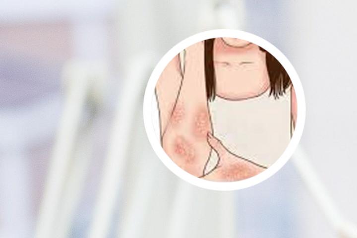 牛皮癣小广告的手抄报