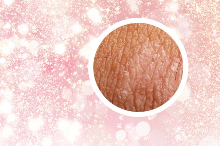 手踝关节疼银屑病