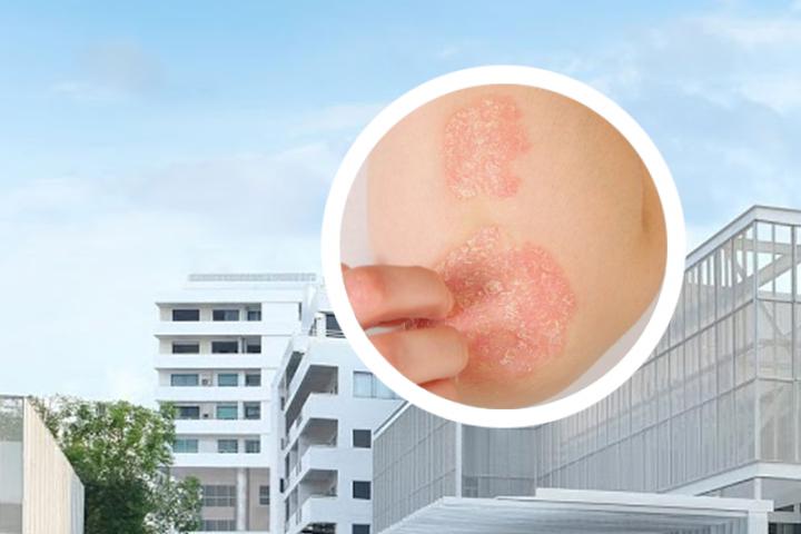 快手里治疗牛皮癣的可信吗