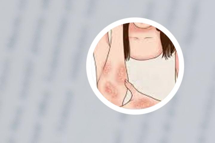 牛皮癣能吃唐狮鱼