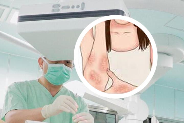 银屑病治疗几天见效