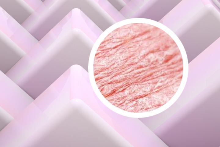 银屑病光疗后浑身痒